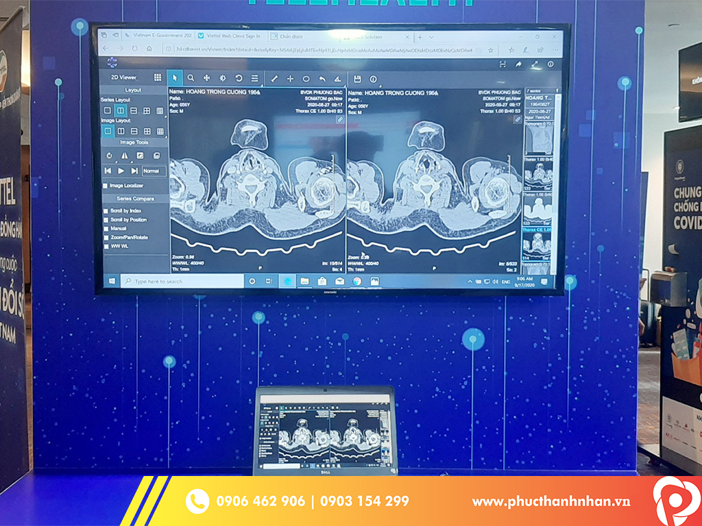 Cho thuê tivi 70 inch